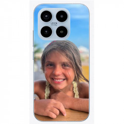 Coque Xiaomi 17 personnalisable en gel